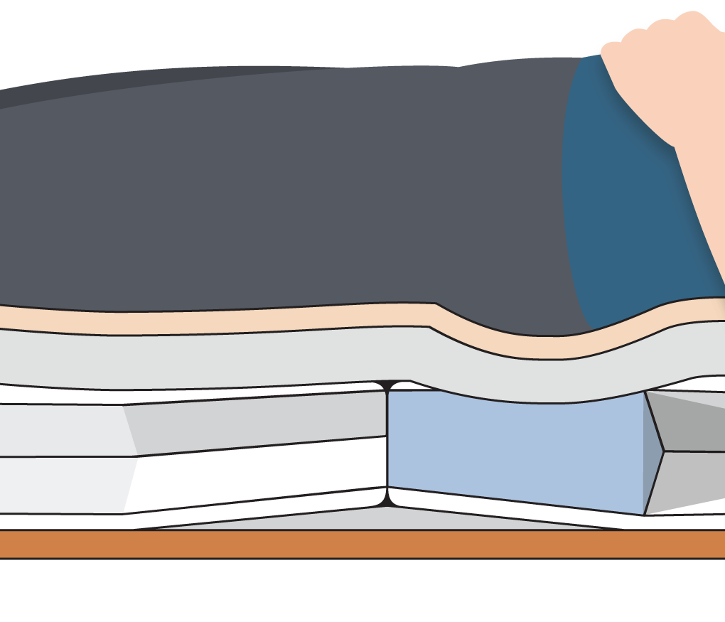 Alaise Pumpless Hybrid Pressure Care Mattress - Image 9